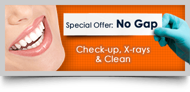 Special offer:No Gap Dental Check-up, X-rays and Teeth Cleaning
